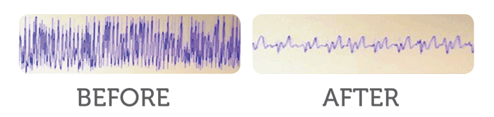 ScreenShot-before-after-sb