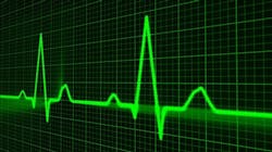1660601523811 Pulsetracefb 1660601523811 Pulsetracefb